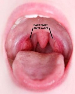 tonsils in child